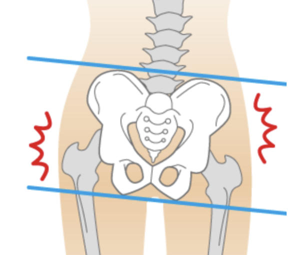 骨盤矯正（産後）も承っております。