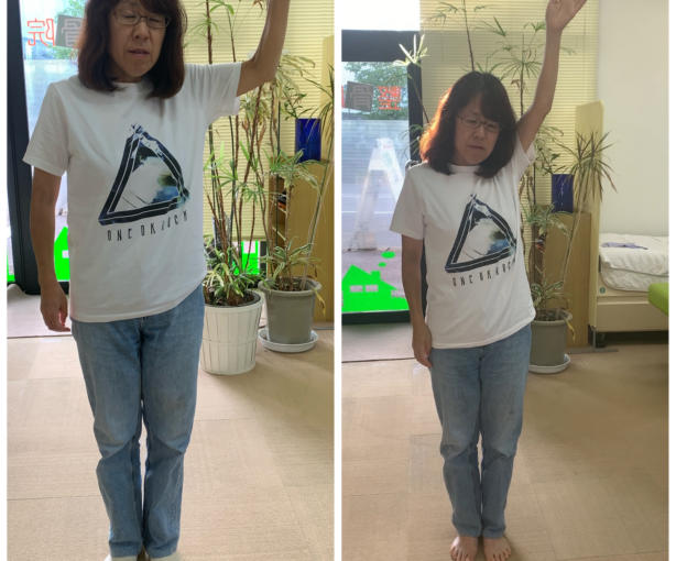 五十肩で上がらなかった肩が一回の施術で上がるようになりました。